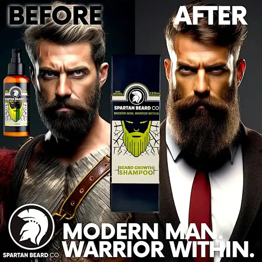 𝗦𝗣𝗔𝗥𝗧𝗔𝗡 𝗕𝗘𝗔𝗥𝗗™ Shampoo (80% OFF - Pesanan Pertama)